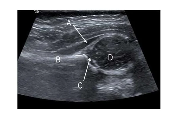 Ultrasound Images