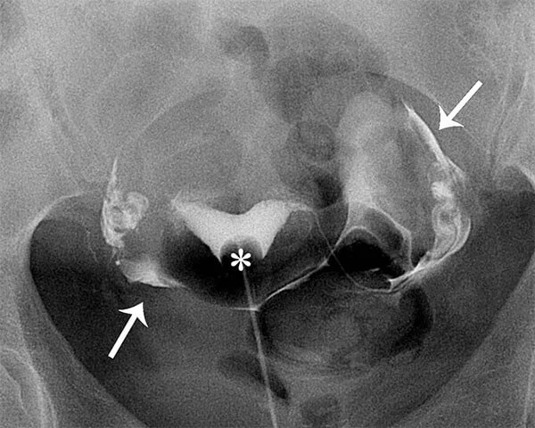 Ultrasound Images