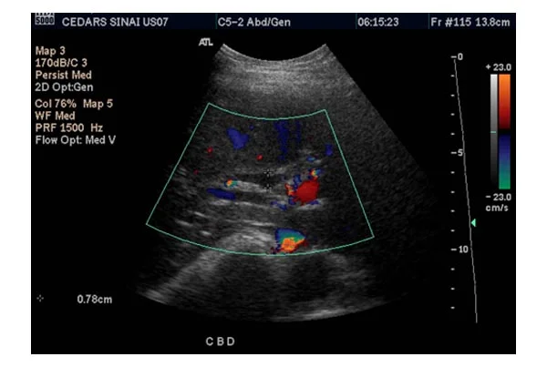 Ultrasound Images