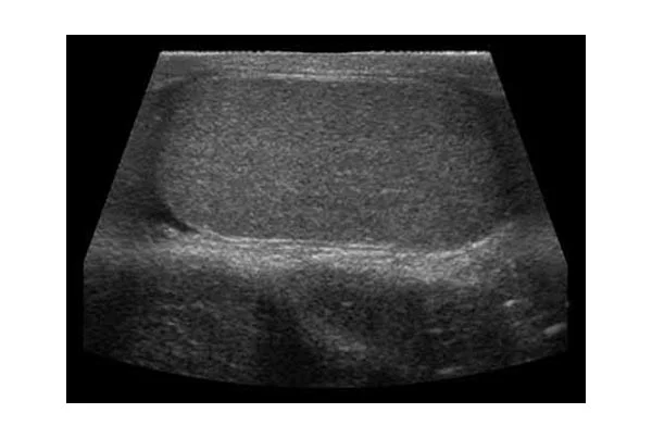 Ultrasound Images