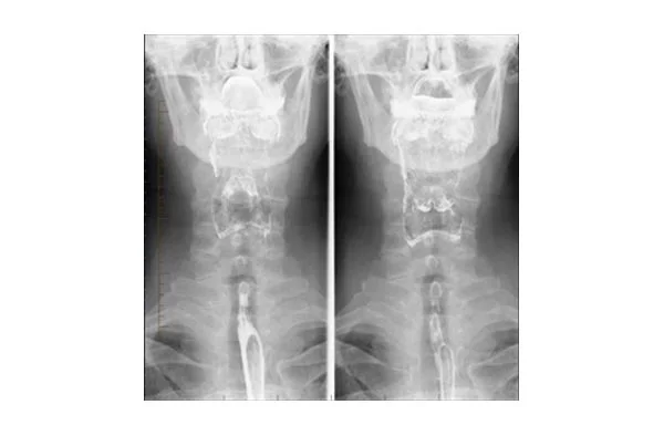 X-Rays and Special Investigation