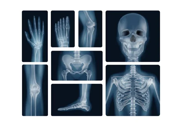 X-Rays and Special Investigation