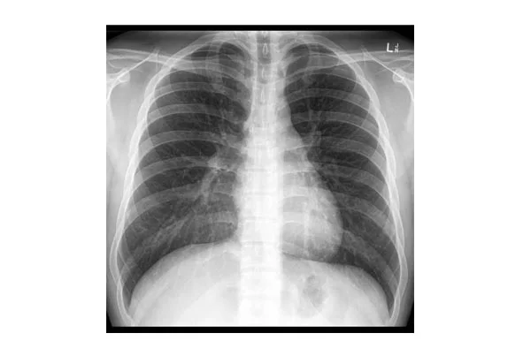 X-Rays and Special Investigation