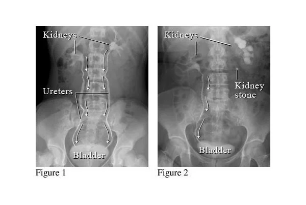 X-Rays and Special Investigation
